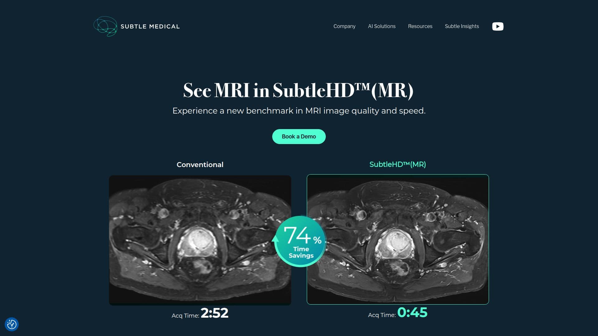 Subtle Medical screenshot